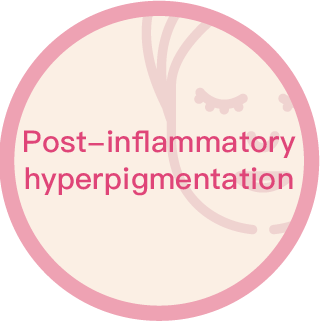 Post Inflammatory Hyperpigmentation